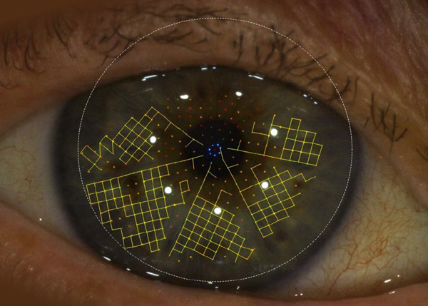 Image of a complete eye measurement of a stable tear film